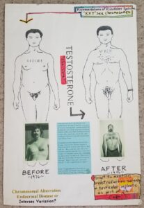 “Representations of the Klinefelter Syndrome: “XXY” Sex Chromosomes”, i.e. before-and-after illustrations (at top) with corresponding photographs of David’s body pre- and post-testosterone replacement therapy (at bottom), 1976-1996. A short excerpt from David’s essay “Caught Between: An Essay on Intersexuality” is placed at bottom center.